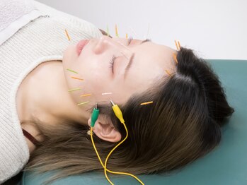 もみの木鍼灸整骨院 恵比寿/電気刺激でリフトアップ