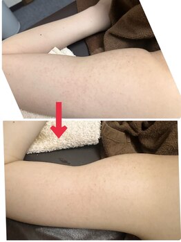 スリリアン 銀座/★お客さまビフォーアフター