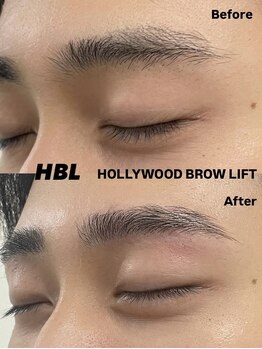 アテナ(ATENA)/ハリウッドブロウリフト