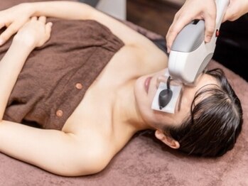 ミオ(mio)の写真/産毛もケアして化粧ノリUP！話題のヴィクトリア脱毛導入店◎通いやすい価格も魅力の顔脱毛を始めませんか☆