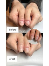 サロンドエヌ(Salon de N)/トラブルネイルも健康的に！