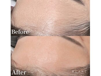 アイラッシュサロン ブラン アリオ川口店(Eyelash Salon Blanc)/眉毛スタイリング×おでこ★