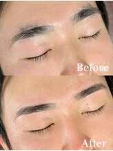 脱毛専門店 美的/メンズ眉ケア