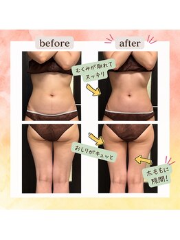 アミュレット(amulette)の写真/40代からの落ちにくい脂肪に集中アプローチ！気になる部分を徹底ケアして、すっきりサイズダウンへ。