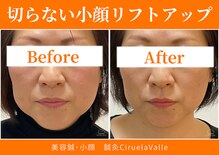 シルエラバレ(CiruelaValle)