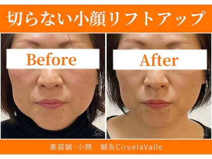 シルエラバレ(CiruelaValle)の写真