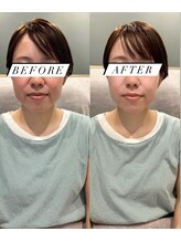 シロ(silo.)/幹細胞導入