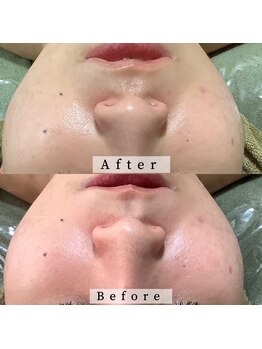 サザンベル 石垣店(SOUTHERN BELLE)/リアボーテタラソトリートメント