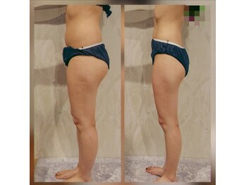 カルナボディ(Carna body.)/質の良いマシンで根本改善