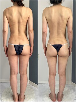 モア(moa)/ガチガチな背中も!