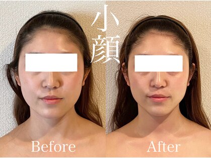 ミベル(MeBell)の写真