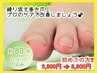 ライト☆目安：爪１枚【巻き爪補正！繰り返さない！】9800→8800円