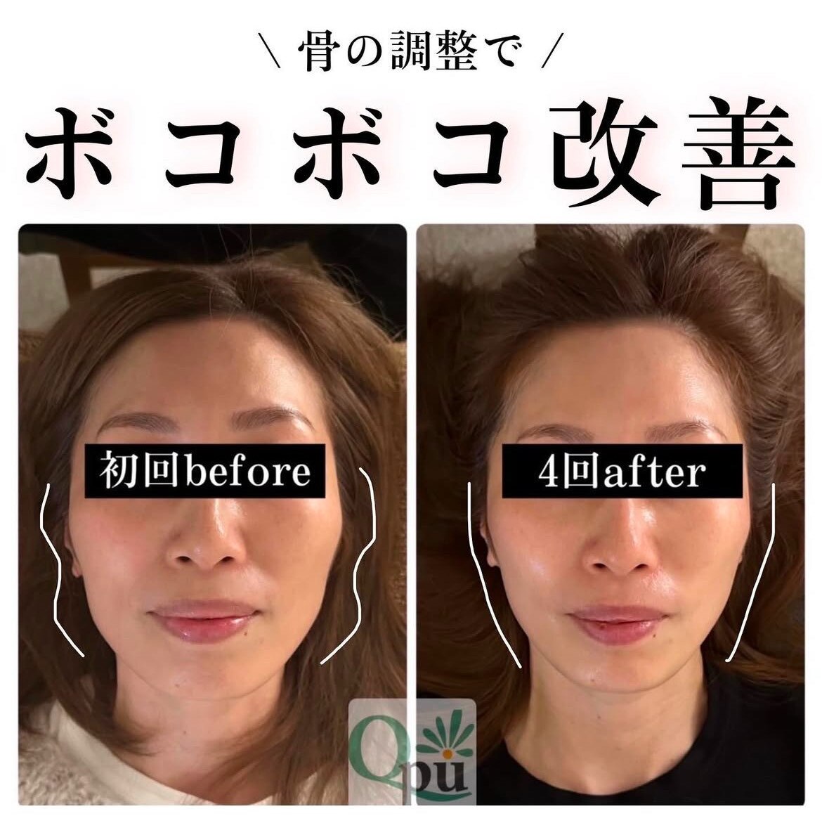 当店人気☆No.1【左右差や歪みに】小顔頭蓋骨矯正+リンパケア￥8200→￥7100