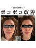 当店人気No１★小顔頭蓋骨矯正+リンパケア￥8200→￥7100左右差や歪みに◎