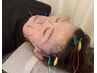 美容鍼×頭皮鍼