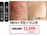 TIPハーブピーリング(ハードケア)