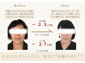 アロハ(ALOHA.)/その悩み、本当に"年齢のせい"?