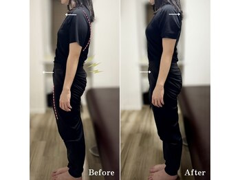 ジェイミープラス 表参道(J‘aimee +)/姿勢矯正ビフォーアフター