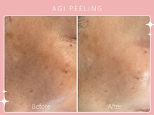 シロカネ 光の森店(SHIROKANE)/アギピーリング☆