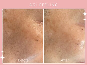 シロカネ 光の森店(SHIROKANE)/アギピーリング☆