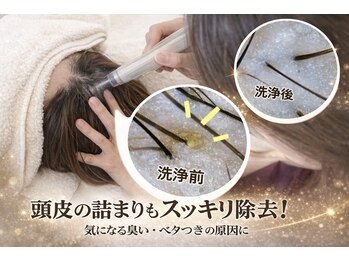 プラチナムスーパースカルプ 宮崎市店(PLATINUMスーパースカルプ)/