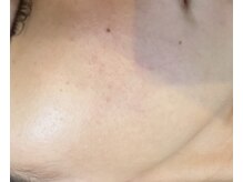 ペリドット(Peridot)/