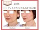 リュミエール(Lumiere)の写真