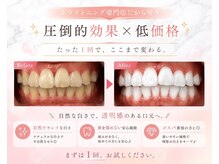 LBSホワイトニング 上野店