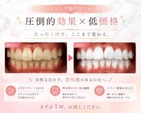 LBSホワイトニング 上野店