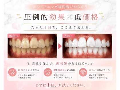 LBSホワイトニング 上野店の写真