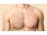 胸毛（乳輪含む）WAX＋光 最強ダブル脱毛！