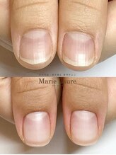 マリーロール 梅田店(Marie Laure)/自爪育成/深爪矯正/ネイルケア