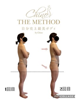 アンベリール(Embellir)/チノザメソッドBefor・After