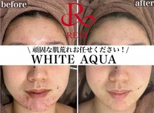 ホワイトアクア 大分店(WHITE AQUA)