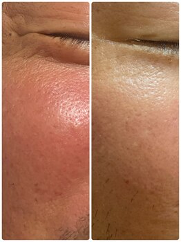 ステラフィールド(stella field)/プラズマカリファ　