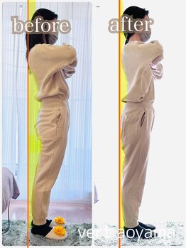 ヴェール 青山(vert)/骨盤矯正【骨盤が広がる姿勢】
