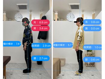 トワニ整体 新富町院(TOWANI整体)/猫背/銀座/新富町/築地/整体