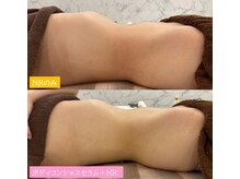 効果抜群！全身引き締めコース