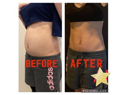 エステティックアンド筋肉ケアサロン グレンツェン(glanzen)の写真
