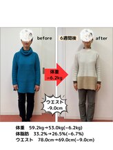 たかみや鍼灸接骨院/耳つぼ＋食事調整でダイエット