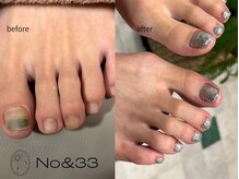 最新フットケア技術だけでは無く、足のあらゆる悩みのサポート