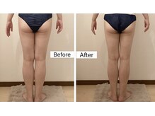 ルシエル ハカタ(Luciel HAKATA)/痩身120分×3回(30代)