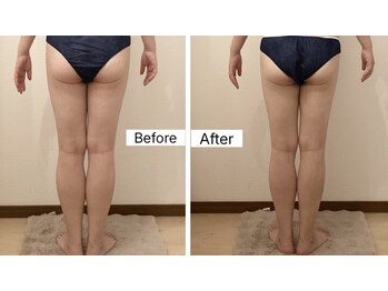 ルシエル ハカタ(Luciel HAKATA)/痩身120分×3回(30代)