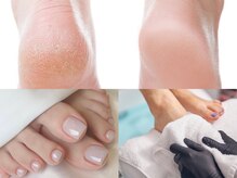 ジェリーネイルズ(JellyNails)の雰囲気（【フットジェル】カサついた甘皮/角質をケアして赤ちゃん肌へ♪）