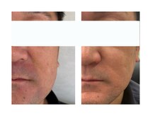 レジュイール(Rejouir)/ホームケアで肌育。