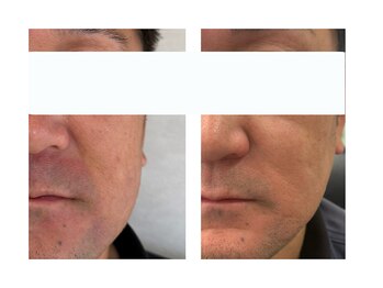 レジュイール(Rejouir)/ホームケアで肌育。