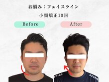 ウェリナ平和堂長久手院/小顔矯正/骨盤矯正/痩身/整体