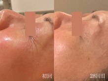 ウォーム(warm)/シワケア/小顔/マッサージ/小顔