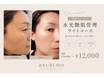 アンドクレモ(&KUREMO)の写真/【本気のエイジングケア】医療提携サロンの最新マシンでシミ・しわを根本ケア★年齢を感じない若々しい肌へ