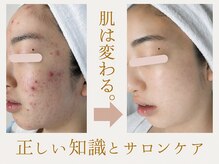 りりあす